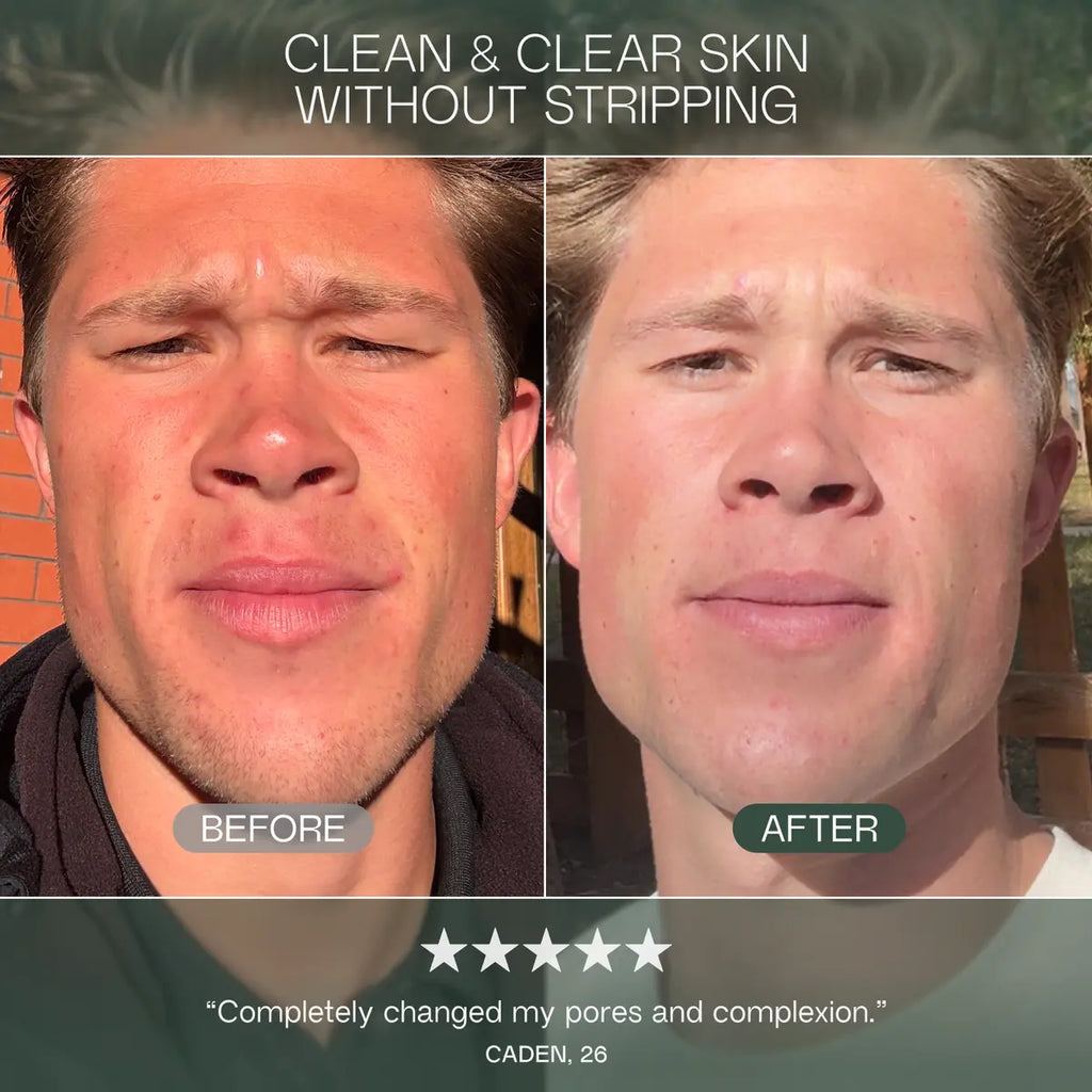 Core set